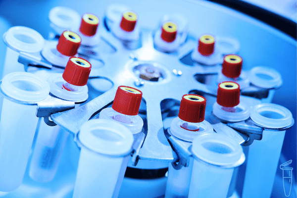 處理Hettich離心機蓋子無法打開的情況